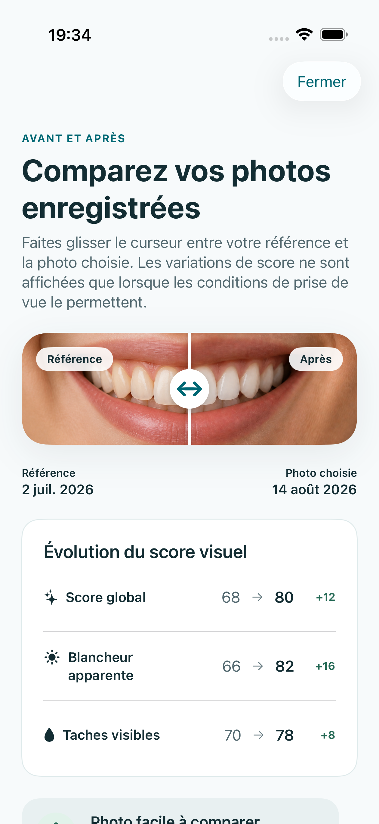Vue déterministe sur simulateur du curseur avant et après avec des recadrages fictifs du sourire.