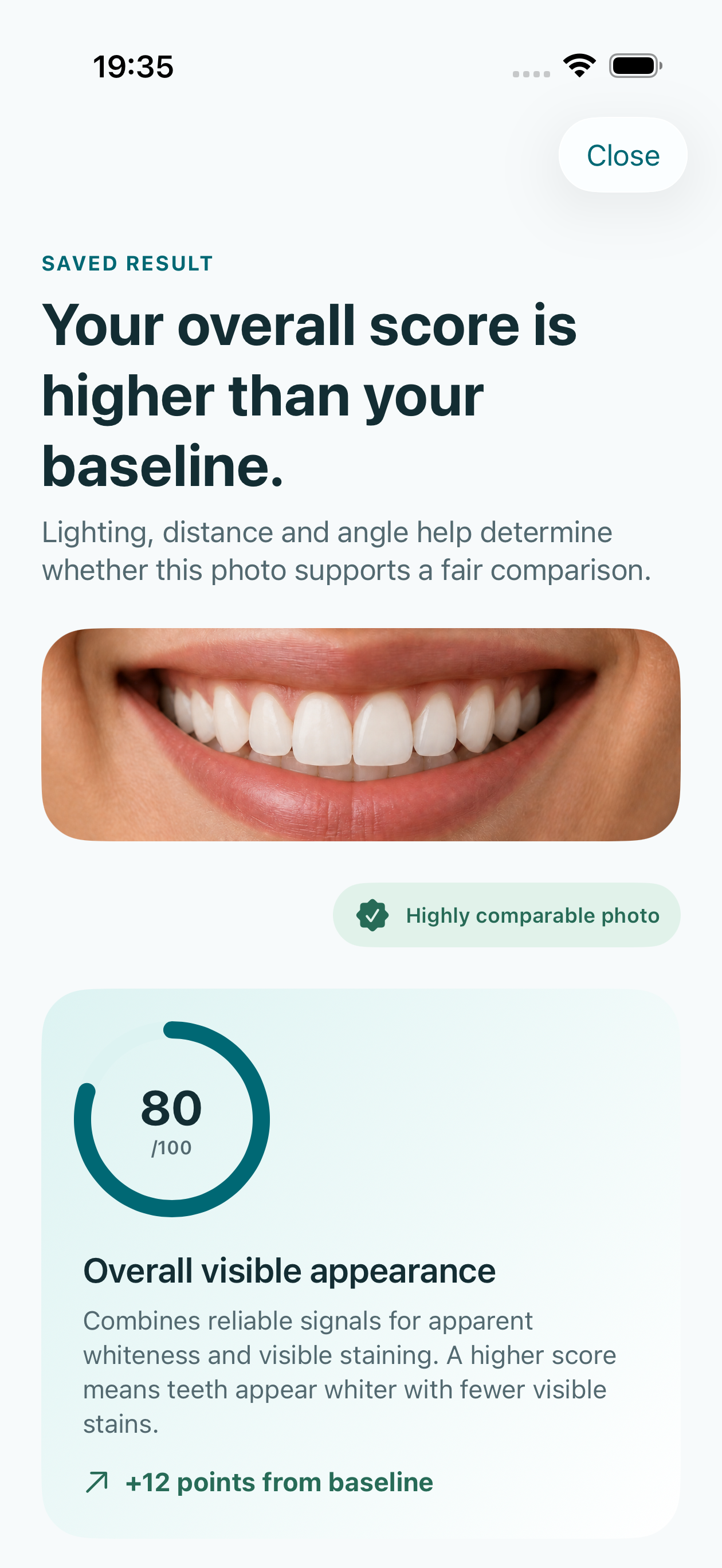 Deterministic simulator preview of a saved Smile Monitor result with a smile crop and overall appearance score.