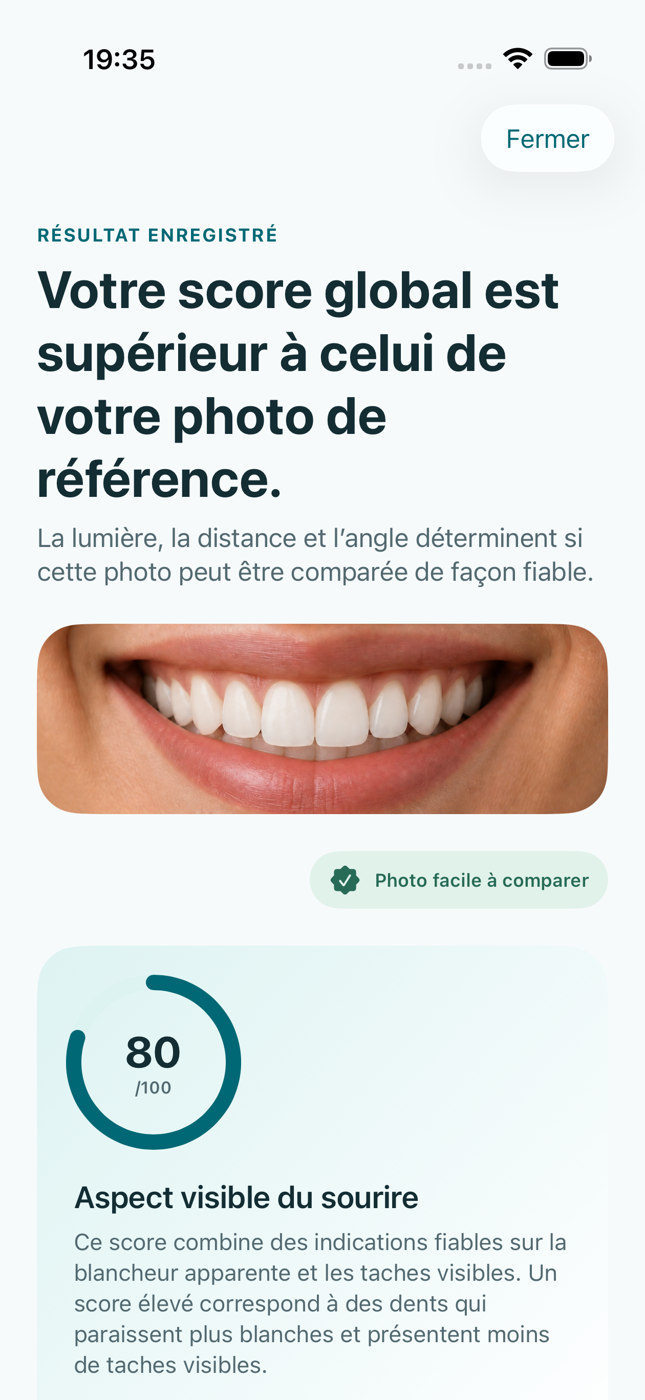Aperçu déterministe sur simulateur d’un résultat Smile Monitor enregistré avec le sourire recadré et le score d’apparence global.