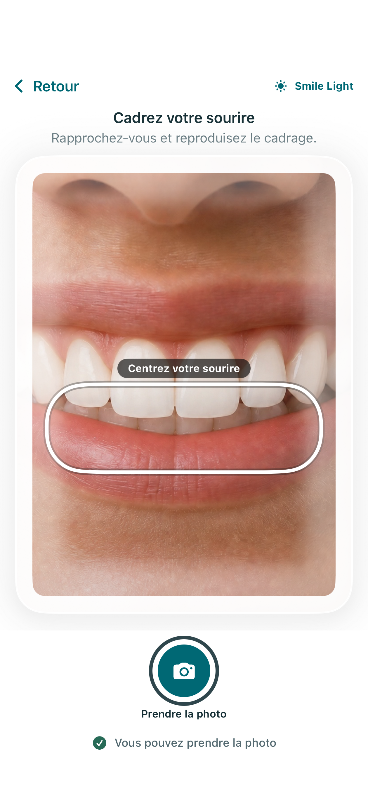 Vue déterministe sur simulateur du repère rapproché du sourire et de l’écran Smile Light.